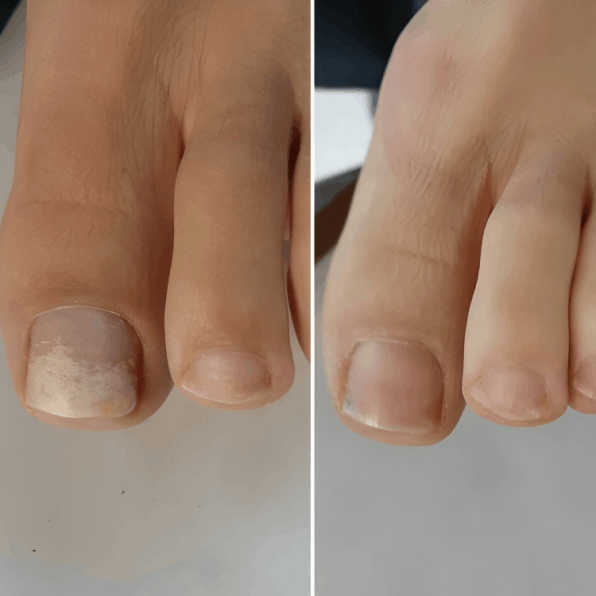 Hewelth BioClear user David S.