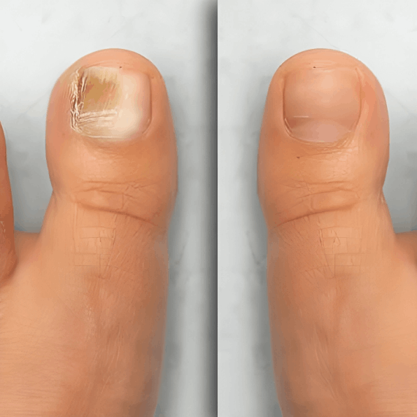 Hewelth BioClear user John H.